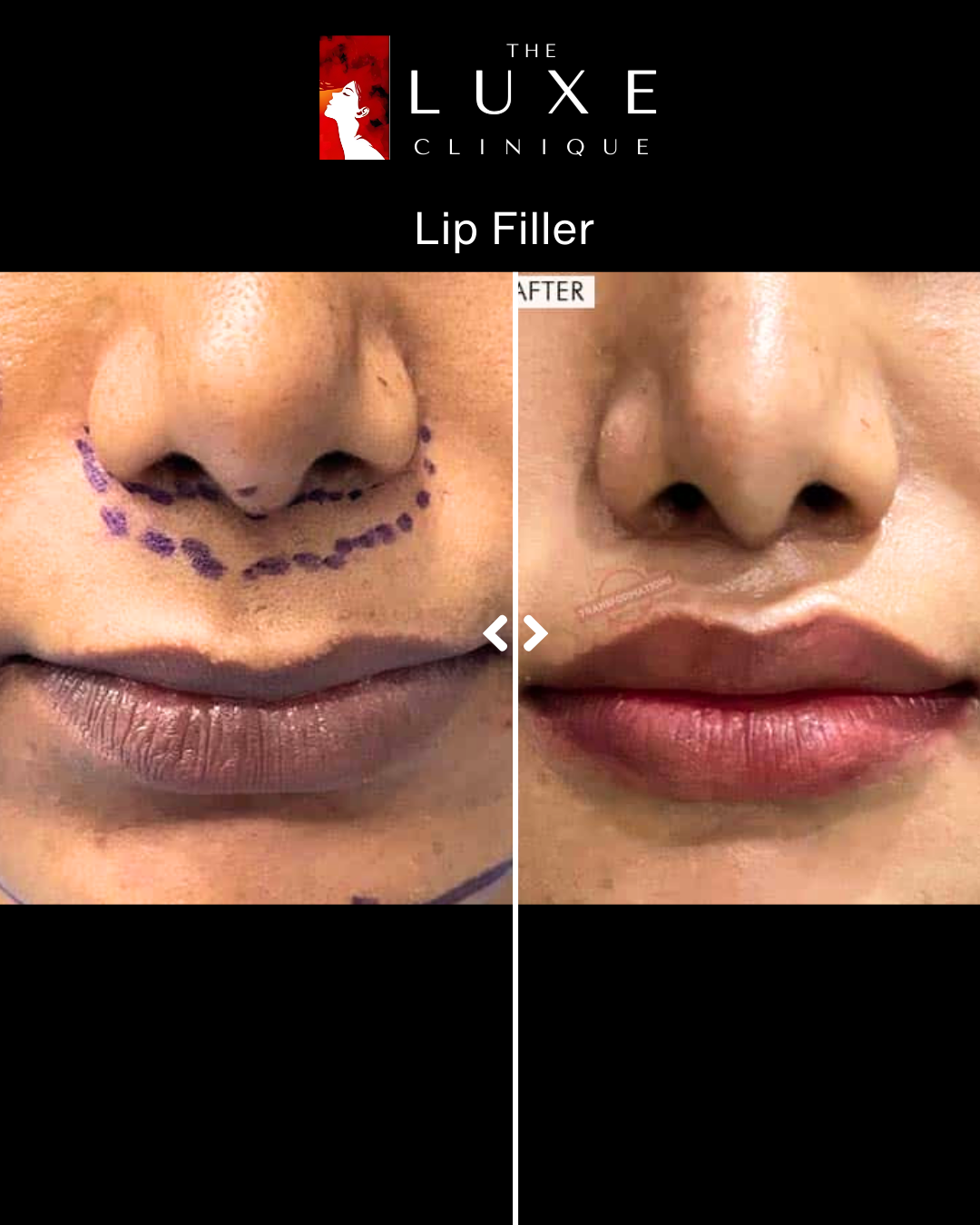 Facial Treatment 4